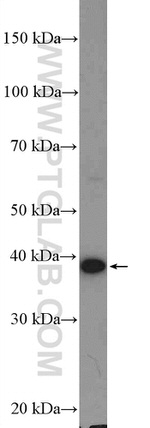 ADPRH Antibody in Western Blot (WB)