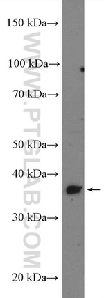 ADPRH Antibody in Western Blot (WB)