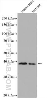 ADPRH Antibody in Western Blot (WB)