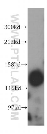 SEC31A Antibody in Western Blot (WB)