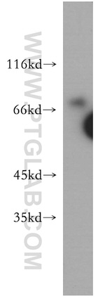 MDMX Antibody in Western Blot (WB)