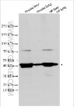KCNE2 Antibody in Western Blot (WB)