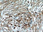 S100A5 Antibody in Immunohistochemistry (Paraffin) (IHC (P))
