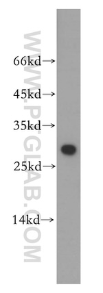 ETFB Antibody in Western Blot (WB)