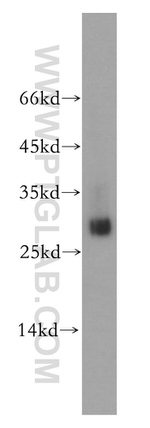 ETFB Antibody in Western Blot (WB)