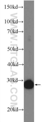 ETFB Antibody in Western Blot (WB)