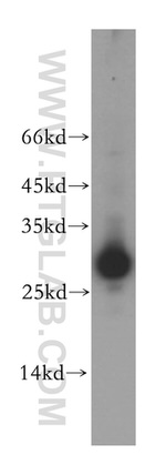 ETFB Antibody in Western Blot (WB)