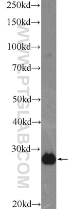 ETFB Antibody in Western Blot (WB)