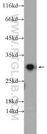 ETFB Antibody in Western Blot (WB)