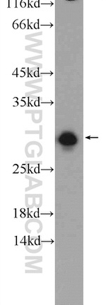 ETFB Antibody in Western Blot (WB)