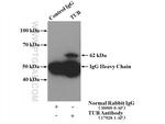 TUB Antibody in Immunoprecipitation (IP)