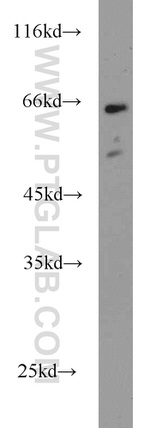 TUB Antibody in Western Blot (WB)