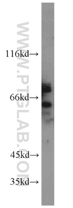 TUB Antibody in Western Blot (WB)