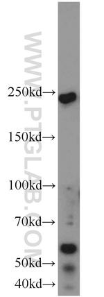 TUB Antibody in Western Blot (WB)