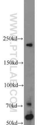 TUB Antibody in Western Blot (WB)