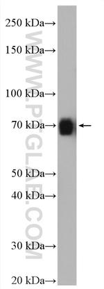 KCNN1 Antibody in Western Blot (WB)