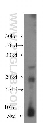 CRYGC Antibody in Western Blot (WB)