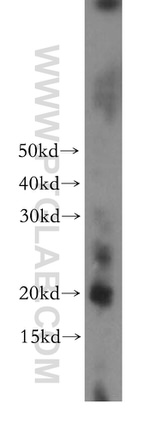 CRYGC Antibody in Western Blot (WB)
