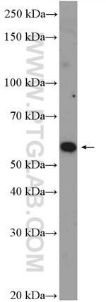 CNOT6 Antibody in Western Blot (WB)