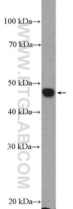 Neurokinin-1 receptor Antibody in Western Blot (WB)