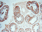 PRR5 Antibody in Immunohistochemistry (Paraffin) (IHC (P))