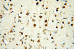 PRR5 Antibody in Immunohistochemistry (Paraffin) (IHC (P))