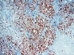 PRR5 Antibody in Immunohistochemistry (Paraffin) (IHC (P))