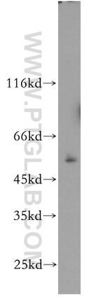 PRR5 Antibody in Western Blot (WB)