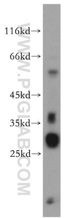 PRR5 Antibody in Western Blot (WB)