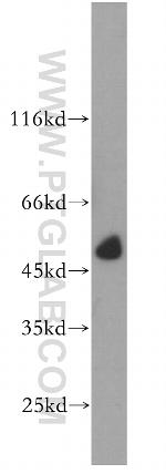 PRR5 Antibody in Western Blot (WB)