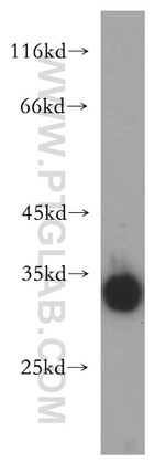 PRR5 Antibody in Western Blot (WB)