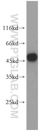 GLRA1 Antibody in Western Blot (WB)
