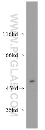 GLRA1 Antibody in Western Blot (WB)