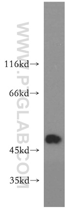 GLRA1 Antibody in Western Blot (WB)