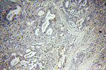 PD-L1/CD274 Antibody in Immunohistochemistry (Paraffin) (IHC (P))