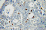 PD-L1/CD274 Antibody in Immunohistochemistry (Paraffin) (IHC (P))