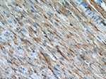 PD-L1/CD274 Antibody in Immunohistochemistry (Paraffin) (IHC (P))