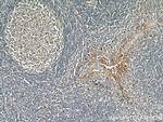 PD-L1/CD274 Antibody in Immunohistochemistry (Paraffin) (IHC (P))