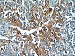 PD-L1/CD274 Antibody in Immunohistochemistry (Paraffin) (IHC (P))