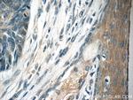 TMPRSS3 Antibody in Immunohistochemistry (Paraffin) (IHC (P))