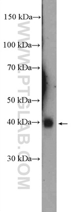 TMPRSS3 Antibody in Western Blot (WB)