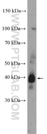 TMPRSS3 Antibody in Western Blot (WB)