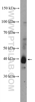 TMPRSS3 Antibody in Western Blot (WB)