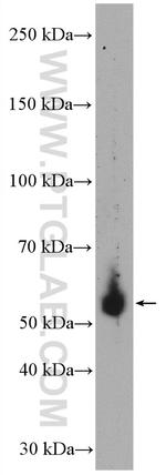 HFE Antibody in Western Blot (WB)