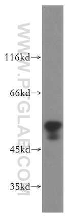 HFE Antibody in Western Blot (WB)
