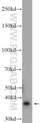 SRR Antibody in Western Blot (WB)