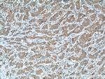 LOX Antibody in Immunohistochemistry (Paraffin) (IHC (P))