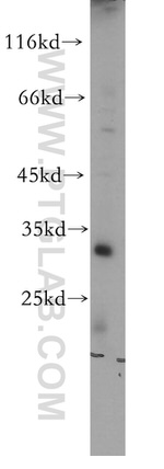 LOX Antibody in Western Blot (WB)