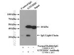 GTF2H2C Antibody in Immunoprecipitation (IP)