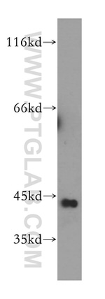 GTF2H2C Antibody in Western Blot (WB)